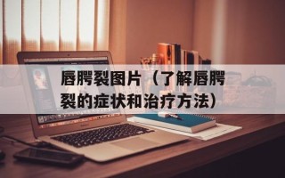 唇腭裂图片（了解唇腭裂的症状和治疗方法）